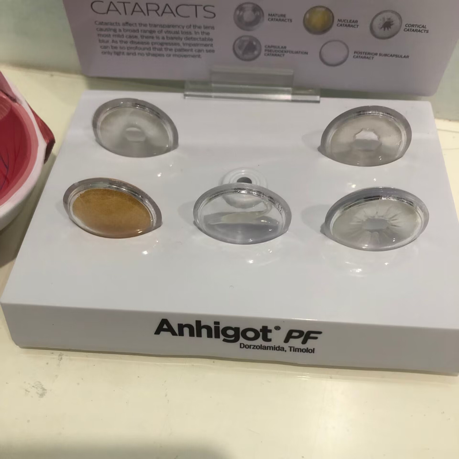 Eye Model Cataract Eye Model,  - Science Exhibition Models ulasan dan harga