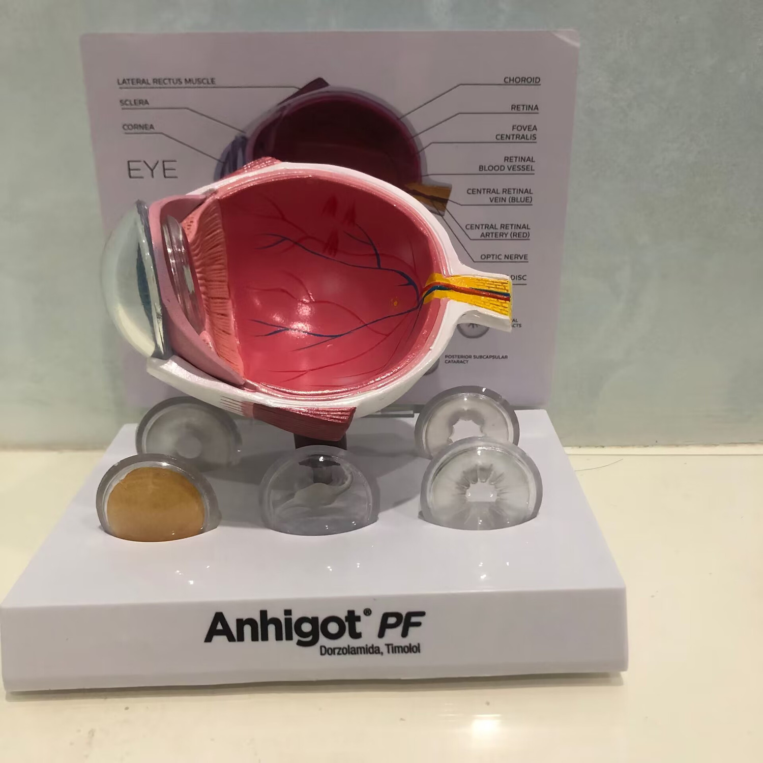 Eye Model Cataract Eye Model,  - Science Exhibition Models ulasan dan harga
